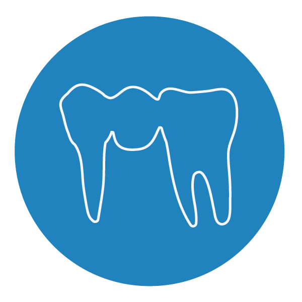 Crown and Bridge Pittman Dental Laboratory